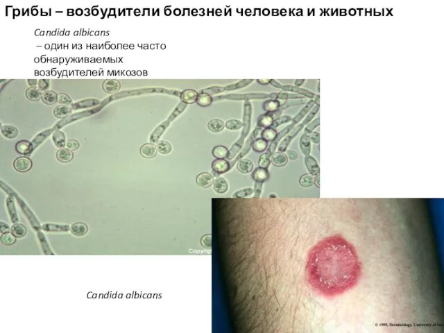 Candida albicans Candida albicans – один из наиболее часто обнаруживаемых возбудителей