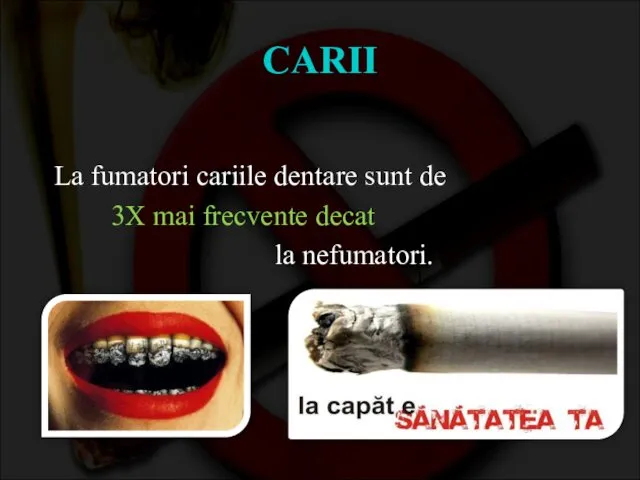 CARII La fumatori cariile dentare sunt de 3X mai frecvente decat la nefumatori.