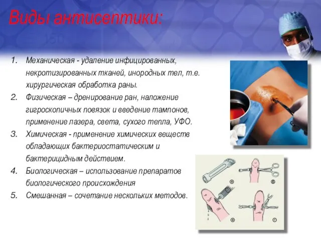 Виды антисептики: Механическая - удаление инфицированных, некротизированных тканей, инородных тел, т.е.