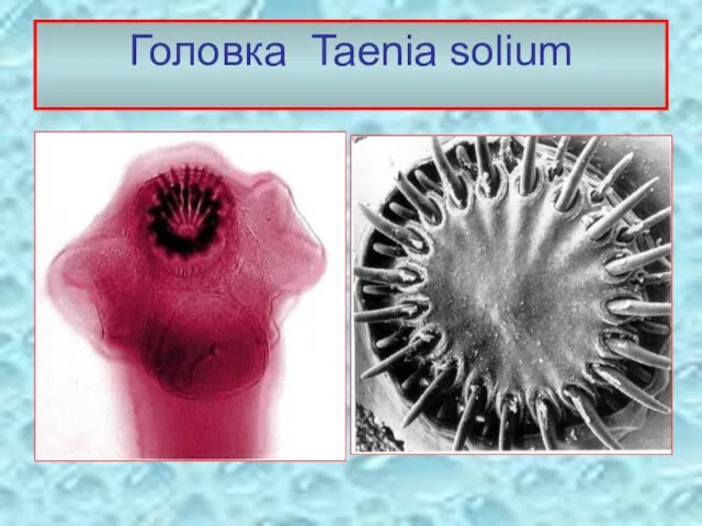 Головка Taenia solium