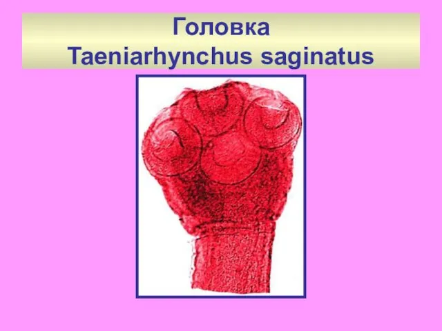 Головка Taeniarhynchus saginatus