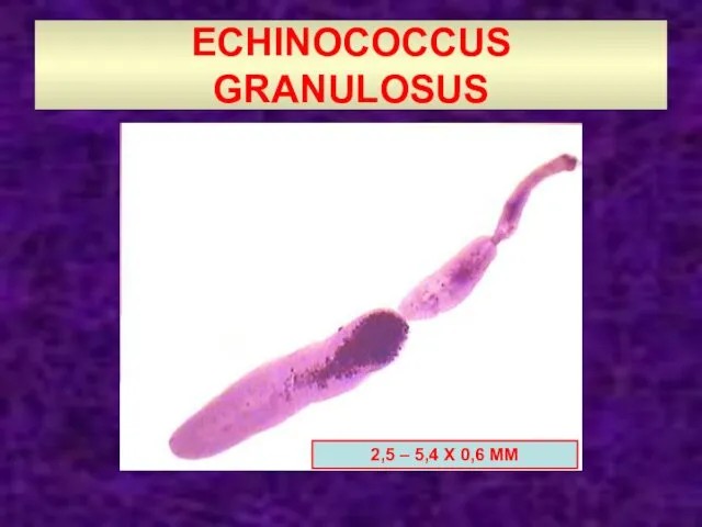 ECHINOCOCCUS GRANULOSUS 2,5 – 5,4 Х 0,6 ММ