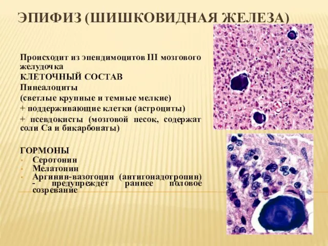 ЭПИФИЗ (ШИШКОВИДНАЯ ЖЕЛЕЗА) Происходит из эпендимоцитов III мозгового желудочка КЛЕТОЧНЫЙ СОСТАВ