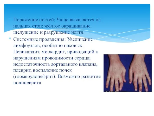 Поражение ногтей: Чаще выявляется на пальцах стоп: жёлтое окрашивание, шелушение и