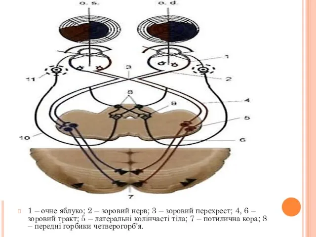 1 – очне яблуко; 2 – зоровий нерв; 3 – зоровий