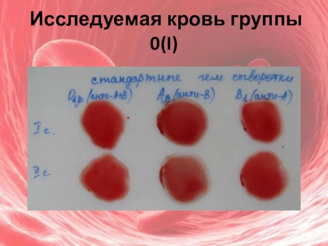 Исследуемая кровь группы 0(I)