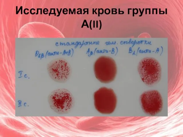 Исследуемая кровь группы А(II)