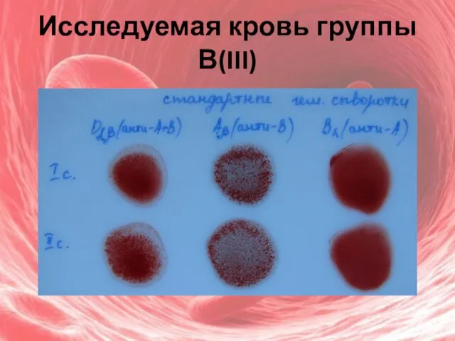 Исследуемая кровь группы В(III)