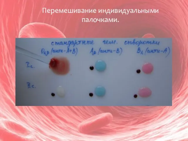 Перемешивание индивидуальными палочками.