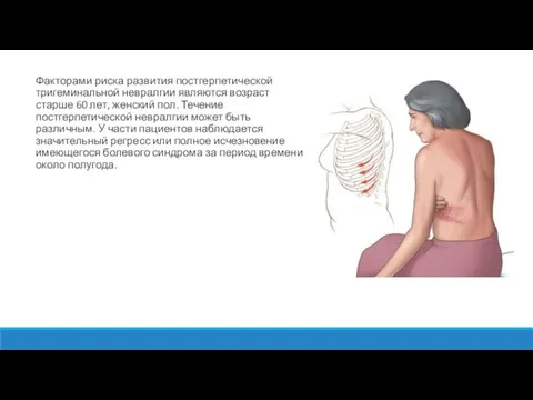 Факторами риска развития постгерпетической тригеминальной невралгии являются возраст старше 60 лет,