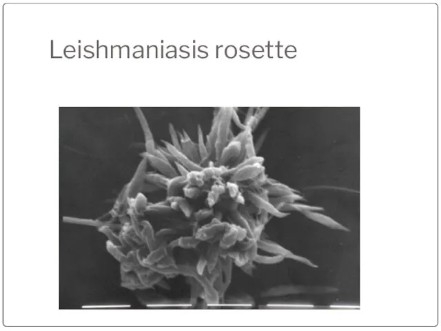 Leishmaniasis rosette