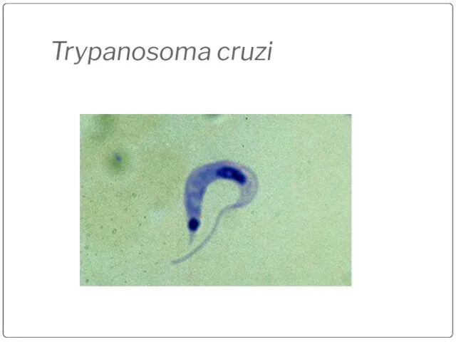 Trypanosoma cruzi