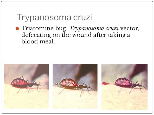 Trypanosoma cruzi Triatomine bug, Trypanosoma cruzi vector, defecating on the wound after taking a blood meal.