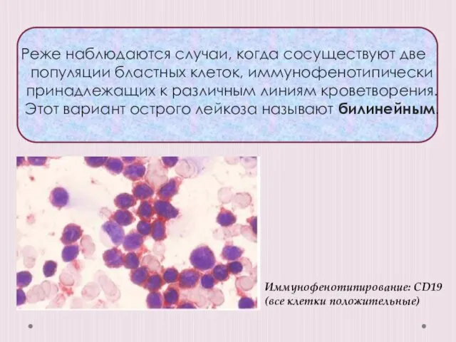 Реже наблюдаются случаи, когда сосуществуют две популяции бластных клеток, иммунофенотипически принадлежащих