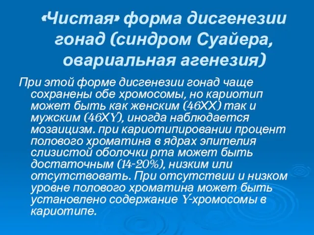 «Чистая» форма дисгенезии гонад (синдром Суайера, овариальная агенезия) При этой форме