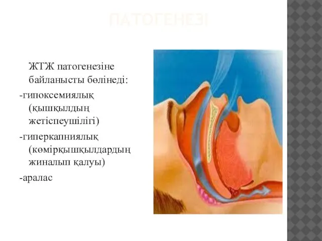 ПАТОГЕНЕЗІ ЖТЖ патогенезіне байланысты бөлінеді: -гипоксемиялық(қышқылдың жетіспеушілігі) -гиперкапниялық(көмірқышқылдардың жиналып қалуы) -аралас