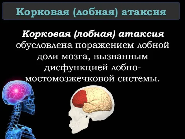 Корковая (лобная) атаксия Корковая (лобная) атаксия обусловлена поражением лобной доли мозга, вызванным дисфункцией лобно-мостомозжечковой системы.