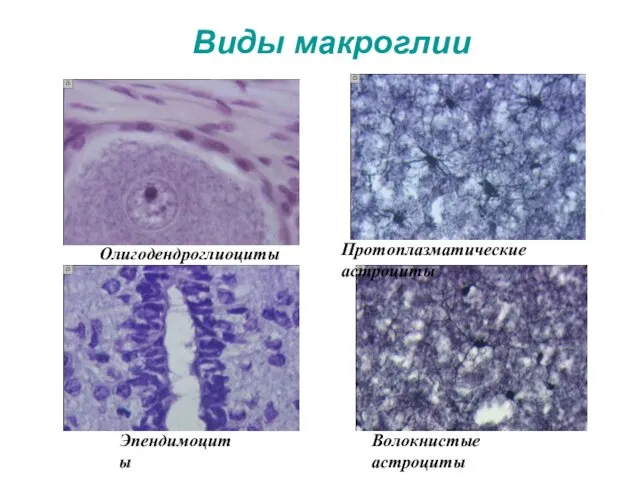 Виды макроглии Олигодендроглиоциты Протоплазматические астроциты Волокнистые астроциты Эпендимоциты