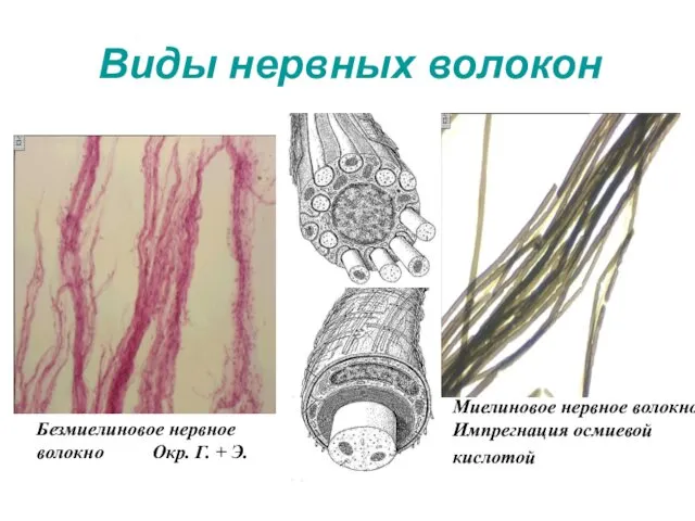 Виды нервных волокон Безмиелиновое нервное волокно Окр. Г. + Э. Миелиновое нервное волокно Импрегнация осмиевой кислотой