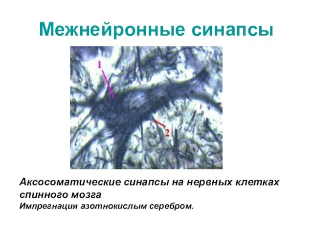 Межнейронные синапсы Аксосоматические синапсы на нервных клетках спинного мозга Импрегнация азотнокислым серебром.