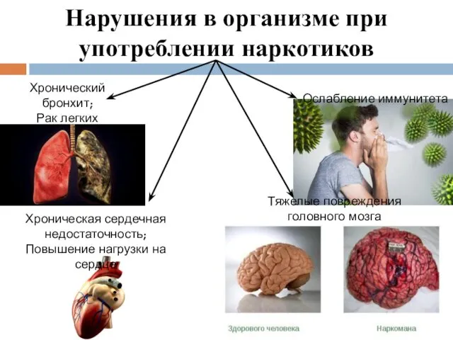 Нарушения в организме при употреблении наркотиков Хронический бронхит; Рак легких Хроническая