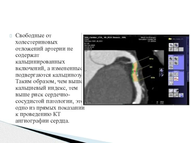 Свободные от холестериновых отложений артерии не содержат кальцинированных включений, а измененные