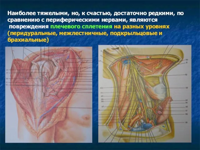 Наиболее тяжелыми, но, к счастью, достаточно редкими, по сравнению с периферическими