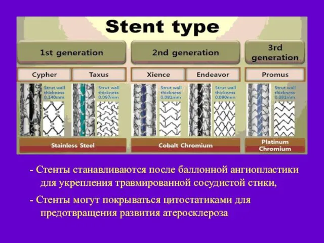 - Стенты станавливаются после баллонной ангиопластики для укрепления травмированной сосудистой стнки,