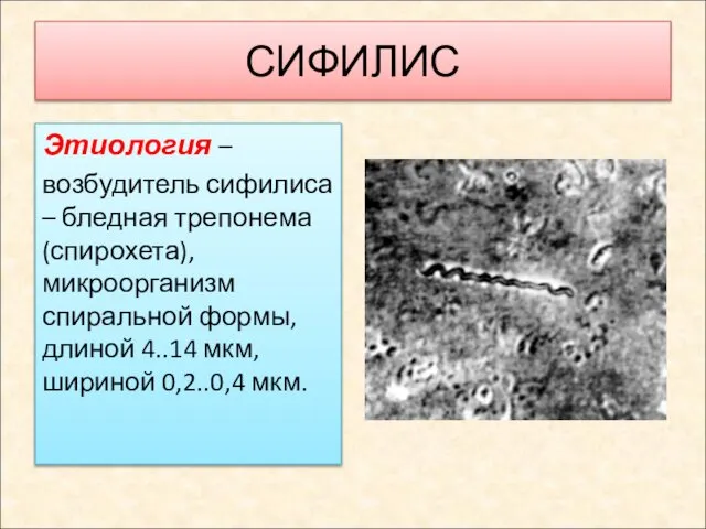 СИФИЛИС Этиология – возбудитель сифилиса – бледная трепонема (спирохета), микроорганизм спиральной