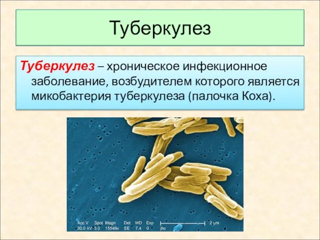 Туберкулез Туберкулез – хроническое инфекционное заболевание, возбудителем которого является микобактерия туберкулеза (палочка Коха).