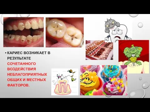 КАРИЕС ВОЗНИКАЕТ В РЕЗУЛЬТАТЕ СОЧЕТАННОГО ВОЗДЕЙСТВИЯ НЕБЛАГОПРИЯТНЫХ ОБЩИХ И МЕСТНЫХ ФАКТОРОВ.