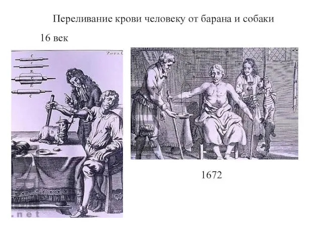 Переливание крови человеку от барана и собаки 1672 16 век