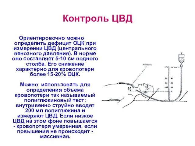 Контроль ЦВД Ориентировочно можно определить дефицит ОЦК при измерении ЦВД (центрального