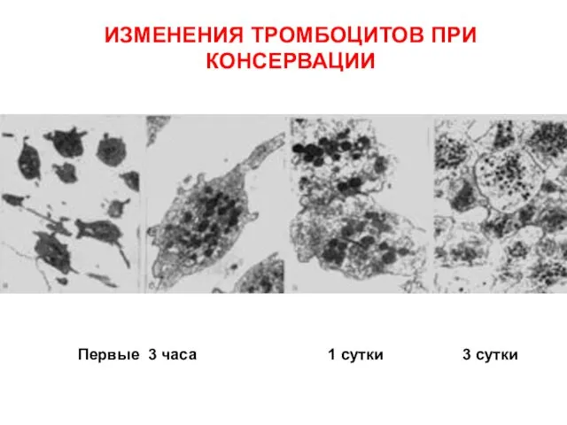 Первые 3 часа 1 сутки 3 сутки ИЗМЕНЕНИЯ ТРОМБОЦИТОВ ПРИ КОНСЕРВАЦИИ