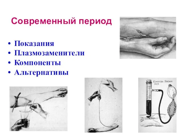 Современный период Показания Плазмозаменители Компоненты Альтернативы