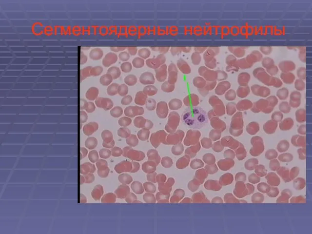 Сегментоядерные нейтрофилы