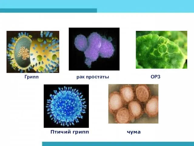 Грипп рак простаты ОРЗ Птичий грипп чума