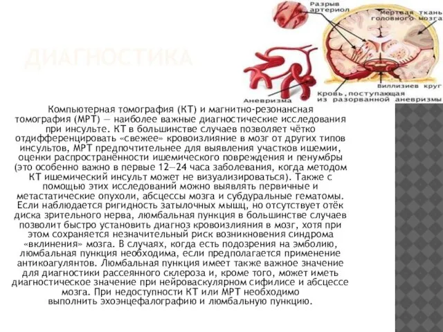 ДИАГНОСТИКА Компьютерная томография (КТ) и магнитно-резонансная томография (МРТ) — наиболее важные