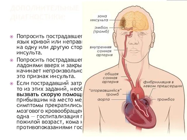 ДОПОЛНИТЕЛЬНЫЕ МЕТОДЫ ДИАГНОСТИКИ: Попросить пострадавшего высунуть язык. Если язык кривой или