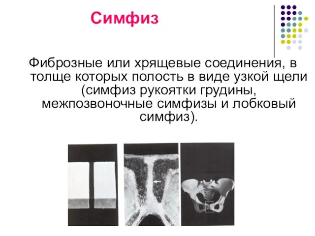 Симфиз Фиброзные или хрящевые соединения, в толще которых полость в виде