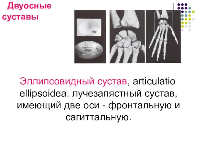 Двуосные суставы Эллипсовидный сустав, articulatio ellipsoidea. лучезапястный сустав, имеющий две оси - фронтальную и сагиттальную.