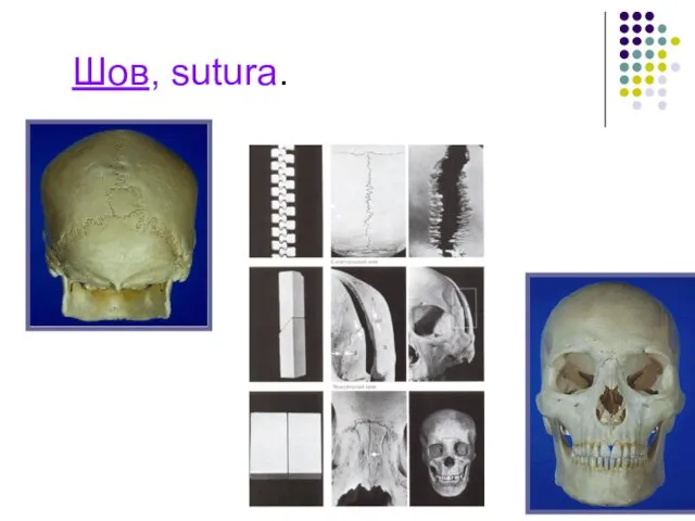 Шов, sutura.