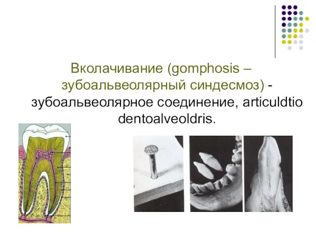Вколачивание (gomphosis – зубоальвеолярный синдесмоз) - зубоальвеолярное соединение, articuldtio dentoalveoldris.