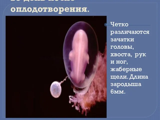 28-день после оплодотворения. Четко различаются зачатки головы, хвоста, рук и ног, жаберные щели. Длина зародыша 6мм.