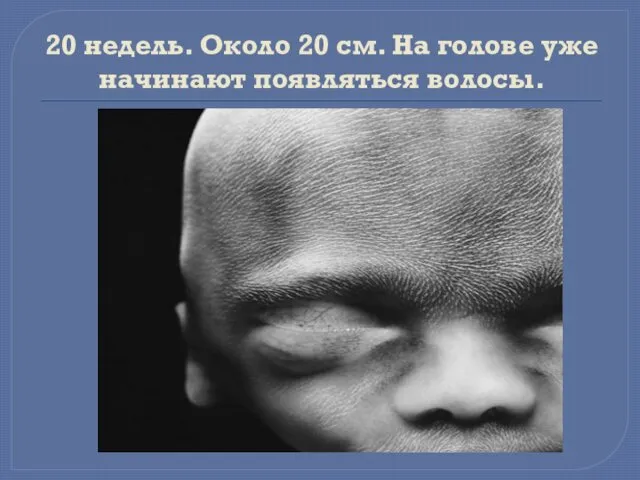 20 недель. Около 20 см. На голове уже начинают появляться волосы.