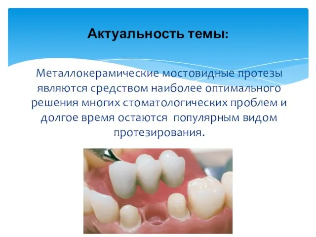 Металлокерамические мостовидные протезы являются средством наиболее оптимального решения многих стоматологических проблем