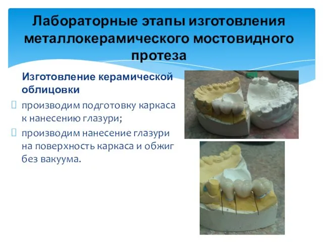 Лабораторные этапы изготовления металлокерамического мостовидного протеза Изготовление керамической облицовки производим подготовку