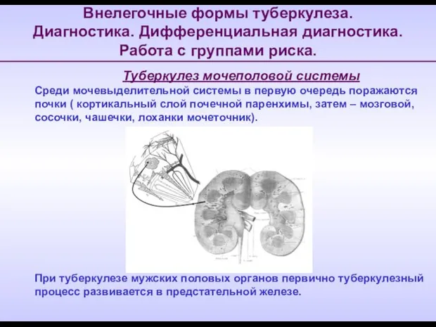 Внелегочные формы туберкулеза. Диагностика. Дифференциальная диагностика. Работа с группами риска. Туберкулез