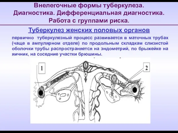 Внелегочные формы туберкулеза. Диагностика. Дифференциальная диагностика. Работа с группами риска. Туберкулез