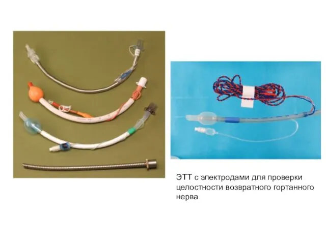 ЭТТ с электродами для проверки целостности возвратного гортанного нерва